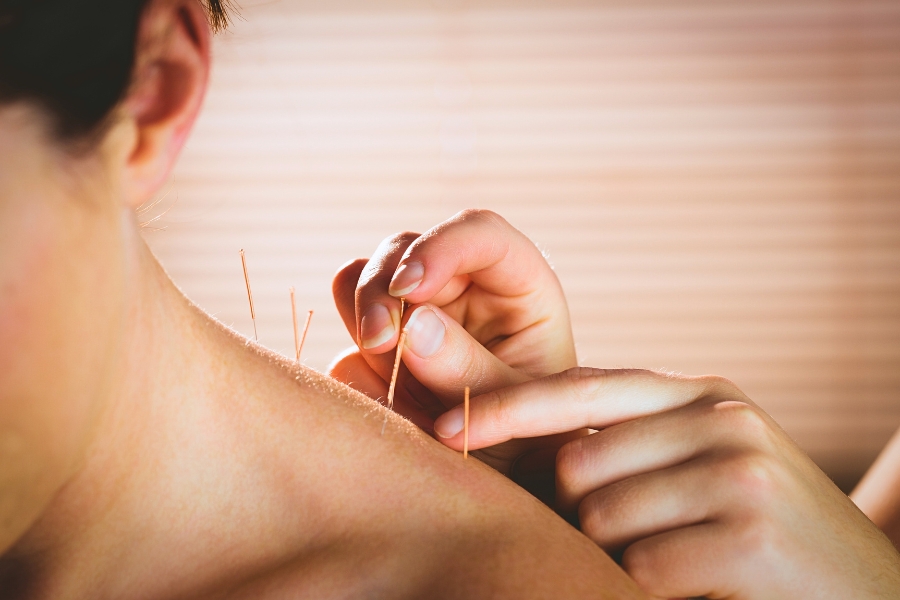 Kurs Akupunktura
