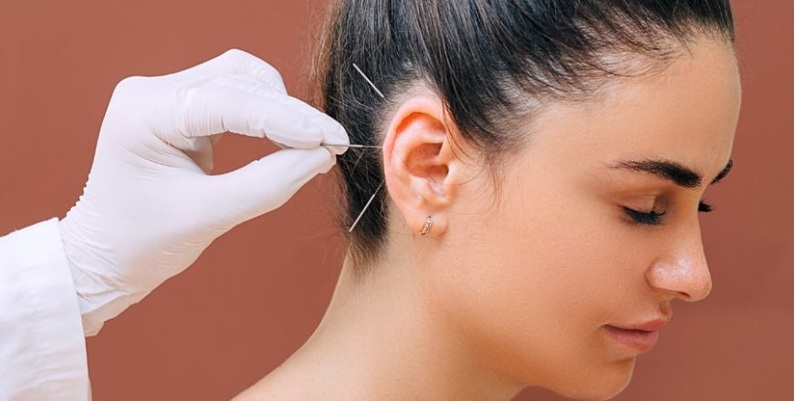 Kurs Akupunktura ucha